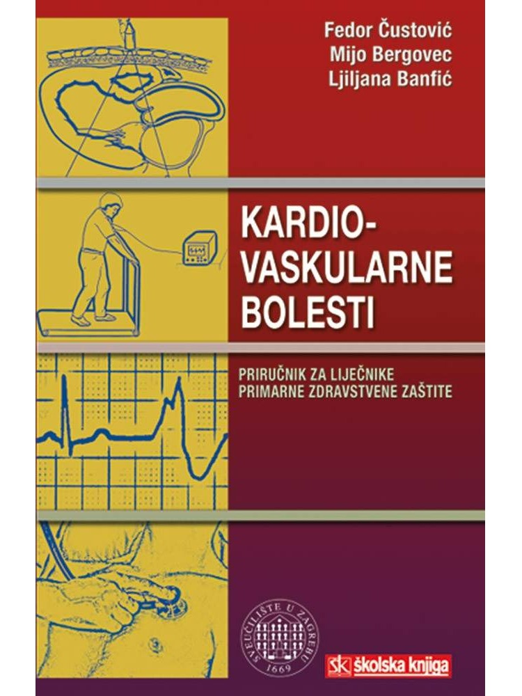 Kardiovaskularne bolesti